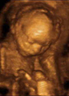 Feto de 16 Semanas